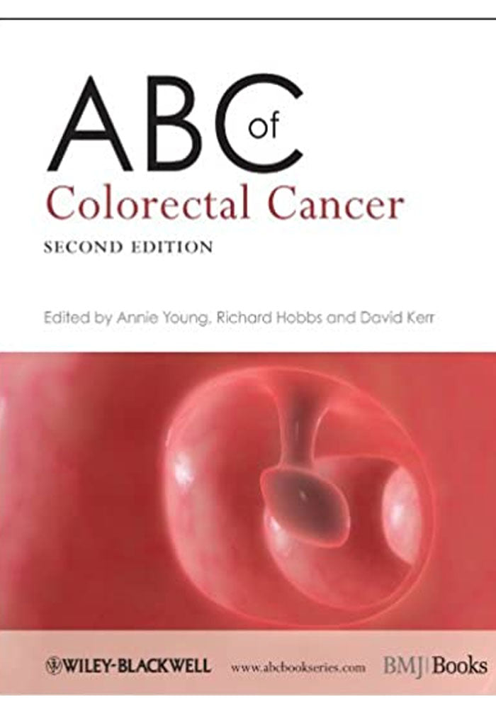 ABC of Colorectal Cancer (ABC Series Book 188) 2nd Edition, Kindle Edition