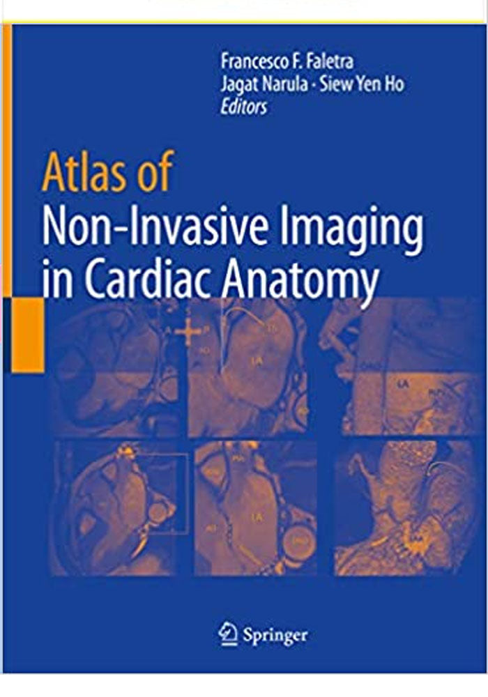 Atlas of Non Invasive Imaging in Cardiac Anatomy