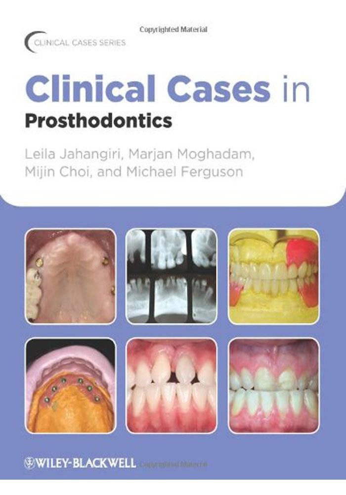 Clinical Cases in Prosthodontics 1st Edition