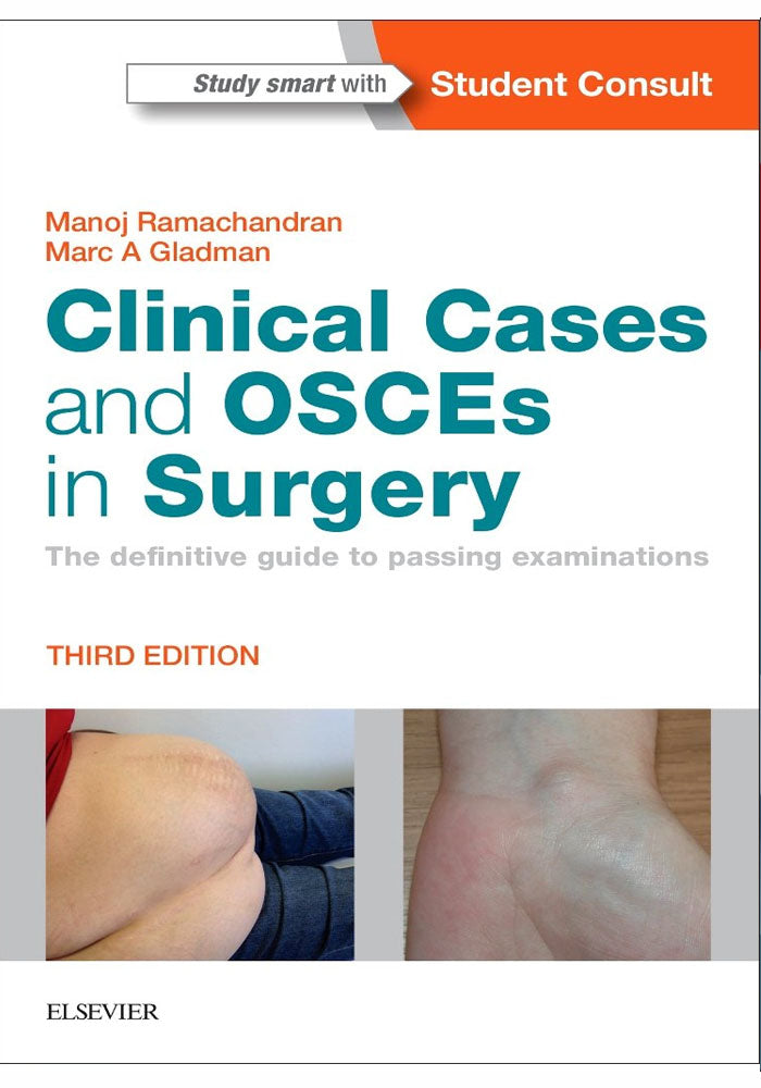 Clinical Cases And OSCEs In Surgery: The Definitive Guide To Passing Examinations 3rd Edición