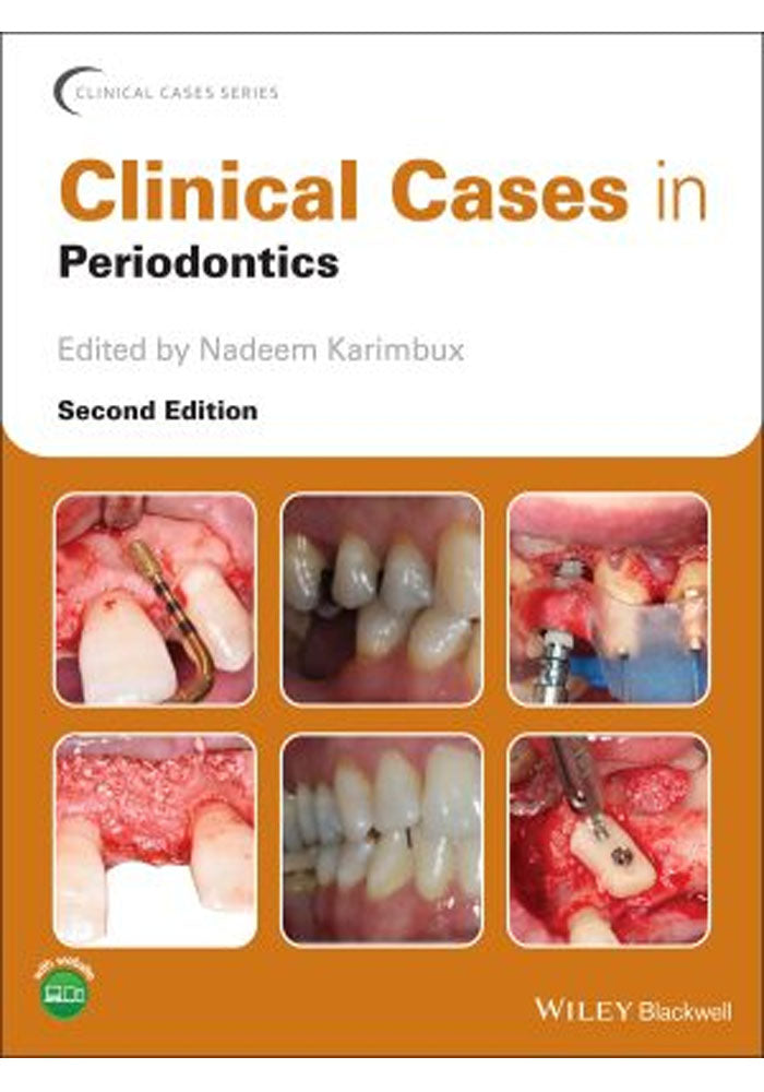 Clinical Cases in Periodontics, 2nd Edition