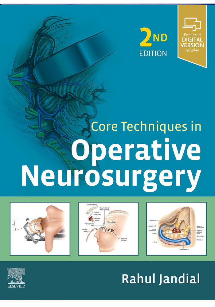 Core Techniques in Operative Neurosurgery 2nd Ed