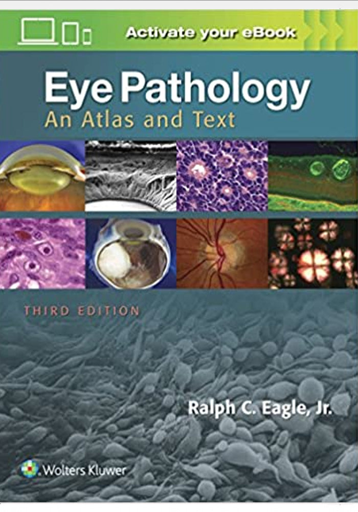 Eye Pathology An Atlas and Text 3rd Ed