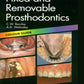 Fixed and Removable Prosthodontics: Color Guide (Color Guides) 2nd Edition