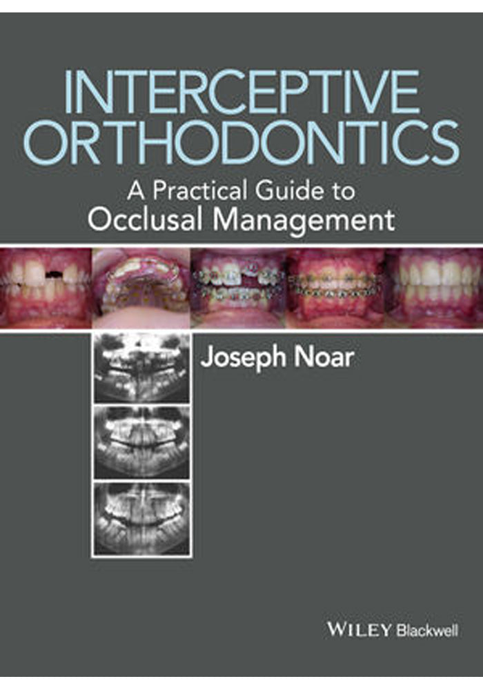 Interceptive Orthodontics A Practical Guide To Occlusal Management