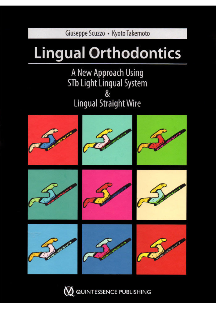 Lingual Orthodontics A New Approach Using Stb Light Lingual System & Lingual Straight Wire