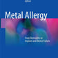Metal Allergy: From Dermatitis to Implant and Device Failure 1st ed. 2018 Edition