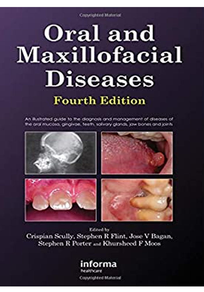 Oral and Maxillofacial Diseases 4th Edition, Kindle Edition