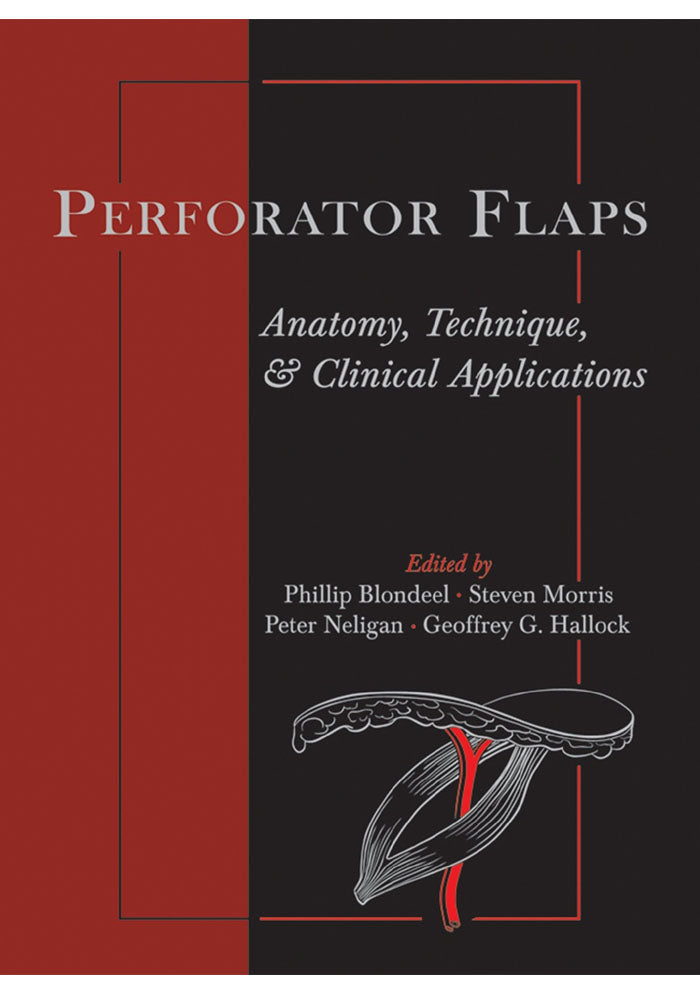 Perforator Flaps: Anatomy, Technique, & Clinical Applications 1st Edition, Kindle Edition