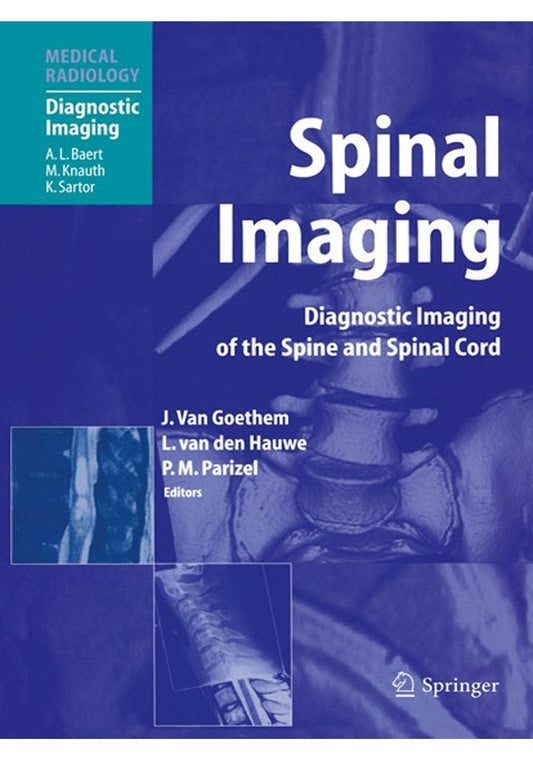 Spinal Imaging: Diagnostic Imaging of the Spine and Spinal Cord (Medical Radiology) 1st Edition