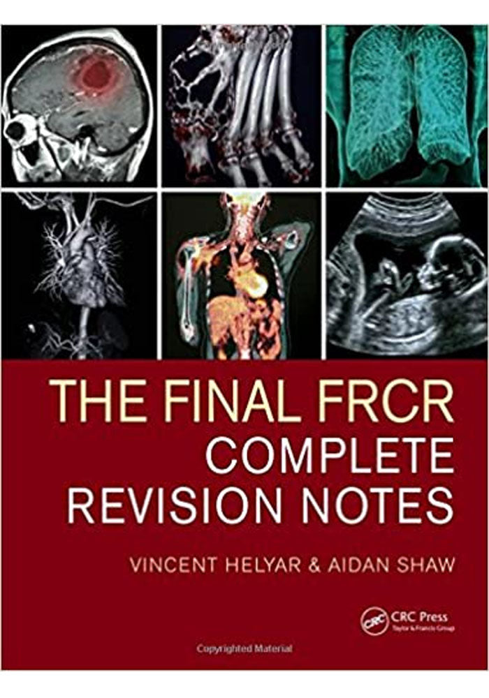 The Final FRCR: Complete Revision